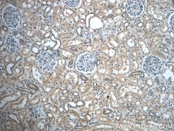 ZC3HAV1L Rabbit anti-Human, Polyclonal, Proteintech 150 &mu;L | Buy Online | Proteintech Group Inc | Fisher Scientific