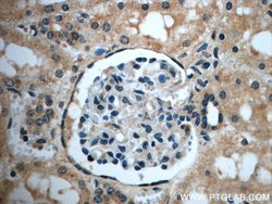 ZC3HAV1L Rabbit anti-Human, Polyclonal, Proteintech 150 &mu;L | Buy Online | Proteintech Group Inc | Fisher Scientific
