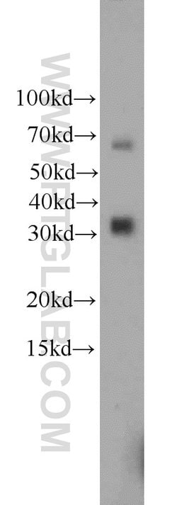 ZC3HAV1L Rabbit anti-Human, Polyclonal, Proteintech 150 &mu;L | Buy Online | Proteintech Group Inc | Fisher Scientific