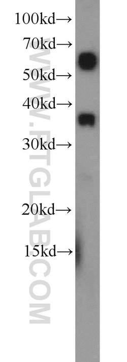ZC3HAV1L Rabbit anti-Human, Polyclonal, Proteintech 150 &mu;L | Buy Online | Proteintech Group Inc | Fisher Scientific