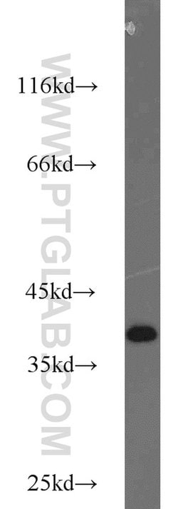 ZC3HAV1L Rabbit anti-Human, Polyclonal, Proteintech 150 &mu;L | Buy Online | Proteintech Group Inc | Fisher Scientific