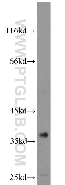 ZC3HAV1L Rabbit anti-Human, Polyclonal, Proteintech 150 &mu;L | Buy Online | Proteintech Group Inc | Fisher Scientific