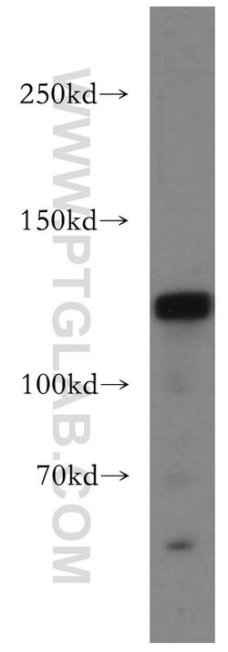 DNMT3A Rabbit anti-Human, Mouse, Rat, Polyclonal, Proteintech 150 &mu;L;