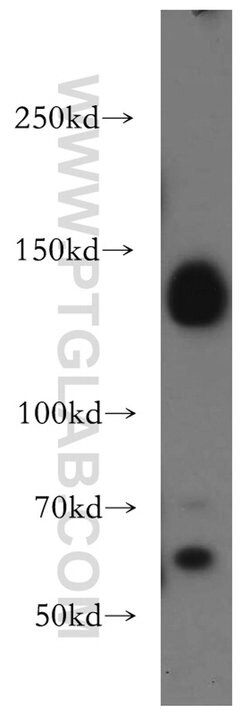 DNMT3A Rabbit anti-Human, Mouse, Rat, Polyclonal, Proteintech 150 &mu;L;
