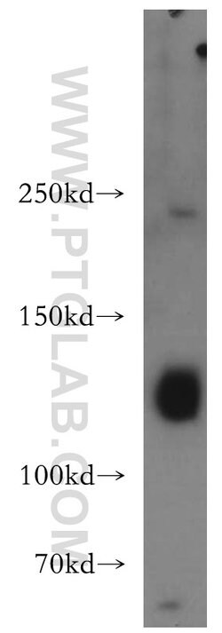 DNMT3A Rabbit anti-Human, Mouse, Rat, Polyclonal, Proteintech 150 &mu;L;