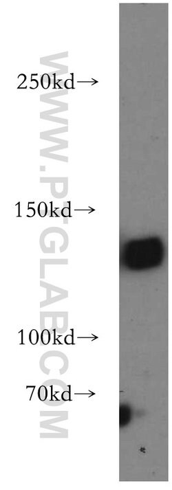 DNMT3A Rabbit anti-Human, Mouse, Rat, Polyclonal, Proteintech 150 &mu;L;