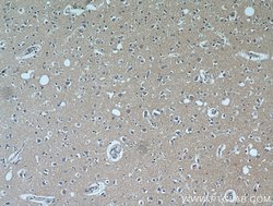 C1orf50 Rabbit anti-Human, Mouse, Polyclonal, Proteintech 150 &mu;L | Buy Online | Proteintech Group Inc | Fisher Scientific