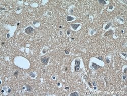 C1orf50 Rabbit anti-Human, Mouse, Polyclonal, Proteintech 150 &mu;L | Buy Online | Proteintech Group Inc | Fisher Scientific