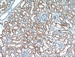 C1orf50 Rabbit anti-Human, Mouse, Polyclonal, Proteintech 150 &mu;L | Buy Online | Proteintech Group Inc | Fisher Scientific