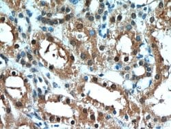 C1orf50 Rabbit anti-Human, Mouse, Polyclonal, Proteintech 150 &mu;L | Buy Online | Proteintech Group Inc | Fisher Scientific