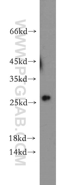 C1orf50 Rabbit anti-Human, Mouse, Polyclonal, Proteintech 150 &mu;L | Buy Online | Proteintech Group Inc | Fisher Scientific