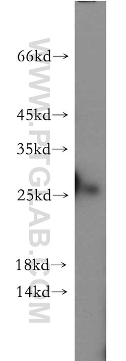 C1orf50 Rabbit anti-Human, Mouse, Polyclonal, Proteintech 150 &mu;L | Buy Online | Proteintech Group Inc | Fisher Scientific