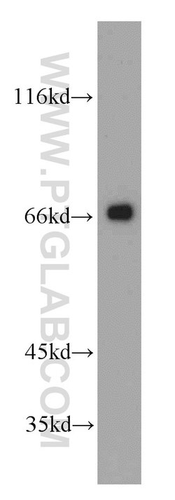 MRPP3 Rabbit anti-Human, Mouse, Rat, Polyclonal, Proteintech 150 &mu;L;
