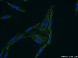 CYP11B2 Rabbit anti-Human, Mouse, Polyclonal, Proteintech:Antibodies:Primary