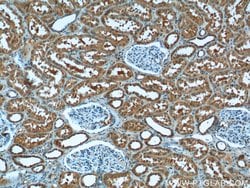 CYP11B2 Rabbit anti-Human, Mouse, Polyclonal, Proteintech:Antibodies:Primary