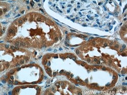 CYP11B2 Rabbit anti-Human, Mouse, Polyclonal, Proteintech:Antibodies:Primary