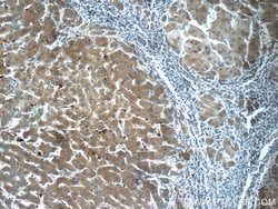 CYP11B2 Rabbit anti-Human, Mouse, Polyclonal, Proteintech:Antibodies:Primary