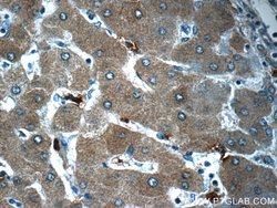 CYP11B2 Rabbit anti-Human, Mouse, Polyclonal, Proteintech:Antibodies:Primary