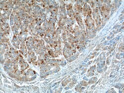 CYP11B2 Rabbit anti-Human, Mouse, Polyclonal, Proteintech:Antibodies:Primary