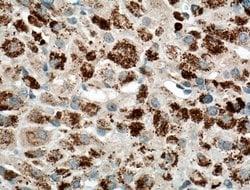 CYP11B2 Rabbit anti-Human, Mouse, Polyclonal, Proteintech:Antibodies:Primary