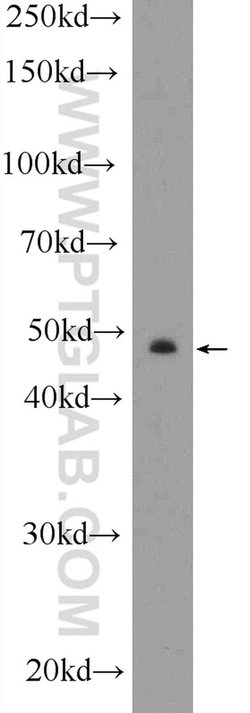 CYP11B2 Rabbit anti-Human, Mouse, Polyclonal, Proteintech:Antibodies:Primary