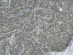 DEPDC6/Deptor Rabbit anti-Human, Mouse, Rat, Polyclonal, Proteintech:Antibodies:Primary