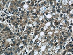 DEPDC6/Deptor Rabbit anti-Human, Mouse, Rat, Polyclonal, Proteintech:Antibodies:Primary
