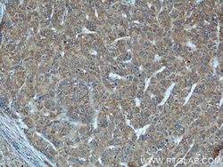 DEPDC6/Deptor Rabbit anti-Human, Mouse, Rat, Polyclonal, Proteintech:Antibodies:Primary