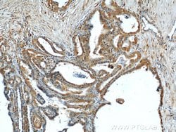 DEPDC6/Deptor Rabbit anti-Human, Mouse, Rat, Polyclonal, Proteintech:Antibodies:Primary