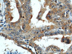 DEPDC6/Deptor Rabbit anti-Human, Mouse, Rat, Polyclonal, Proteintech:Antibodies:Primary
