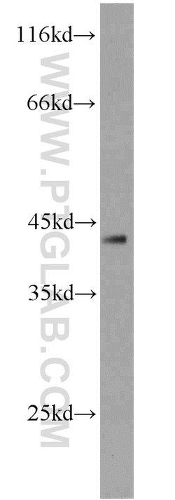 DEPDC6/Deptor Rabbit anti-Human, Mouse, Rat, Polyclonal, Proteintech:Antibodies:Primary