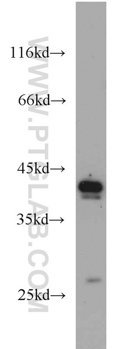 DEPDC6/Deptor Rabbit anti-Human, Mouse, Rat, Polyclonal, Proteintech:Antibodies:Primary