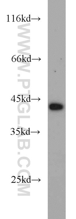 DEPDC6/Deptor Rabbit anti-Human, Mouse, Rat, Polyclonal, Proteintech:Antibodies:Primary