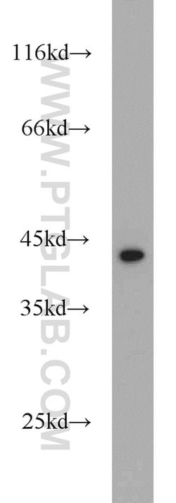 DEPDC6/Deptor Rabbit anti-Human, Mouse, Rat, Polyclonal, Proteintech:Antibodies:Primary