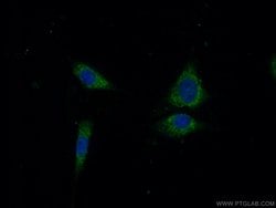 OTUD5 Rabbit anti-Human, Mouse, Polyclonal, Proteintech 150 &mu;L; Unconjugated:Antibodies,