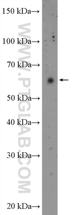 OTUD5 Rabbit anti-Human, Mouse, Polyclonal, Proteintech 150 &mu;L; Unconjugated:Antibodies,