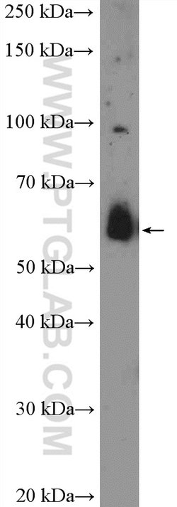 OTUD5 Rabbit anti-Human, Mouse, Polyclonal, Proteintech 150 &mu;L; Unconjugated:Antibodies,