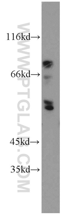 ENTPD8 Rabbit anti-Human, Polyclonal, Proteintech 150 &mu;L; Unconjugated:Antibodies,