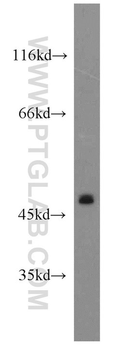 CLEC18A Rabbit anti-Human, Mouse, Rat, Polyclonal, Proteintech 150 &mu;L;