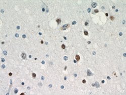 ZNF488 Rabbit anti-Human, Mouse, Rat, Polyclonal, Proteintech:Antibodies:Primary