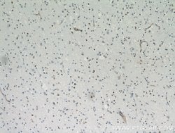 ZNF488 Rabbit anti-Human, Mouse, Rat, Polyclonal, Proteintech:Antibodies:Primary