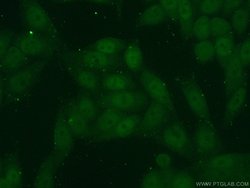 KLF5 Rabbit anti-Human, Mouse, Rat, Polyclonal, Proteintech:Antibodies:Primary