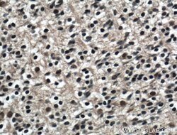 KLF5 Rabbit anti-Human, Mouse, Rat, Polyclonal, Proteintech:Antibodies:Primary