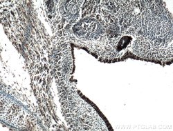 KLF5 Rabbit anti-Human, Mouse, Rat, Polyclonal, Proteintech:Antibodies:Primary