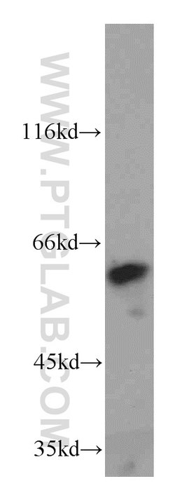 KLF5 Rabbit anti-Human, Mouse, Rat, Polyclonal, Proteintech:Antibodies:Primary
