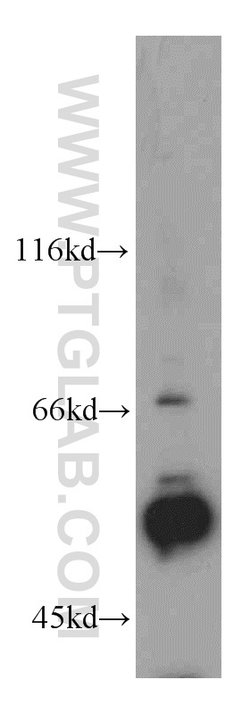 KLF5 Rabbit anti-Human, Mouse, Rat, Polyclonal, Proteintech:Antibodies:Primary