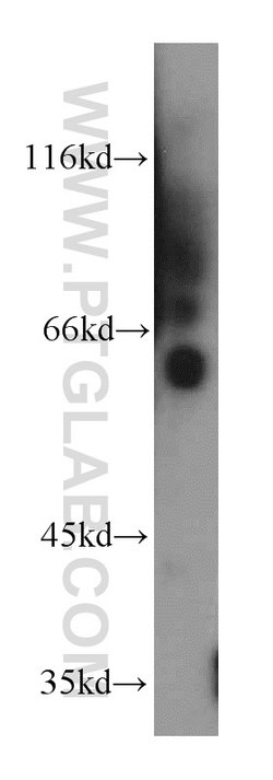 KLF5 Rabbit anti-Human, Mouse, Rat, Polyclonal, Proteintech:Antibodies:Primary