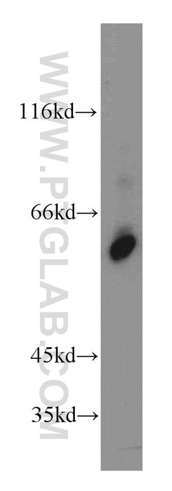 KLF5 Rabbit anti-Human, Mouse, Rat, Polyclonal, Proteintech:Antibodies:Primary