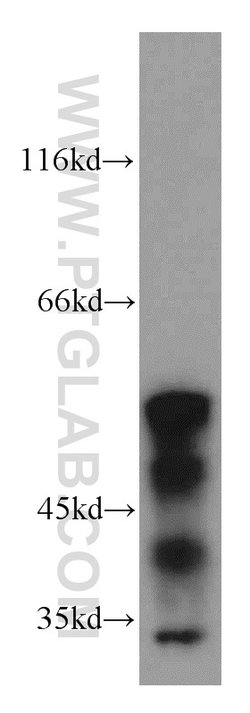 KLF5 Rabbit anti-Human, Mouse, Rat, Polyclonal, Proteintech:Antibodies:Primary