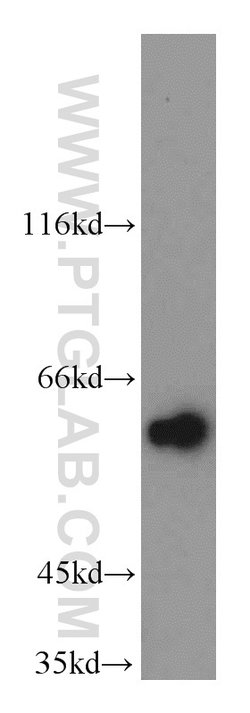 KLF5 Rabbit anti-Human, Mouse, Rat, Polyclonal, Proteintech:Antibodies:Primary